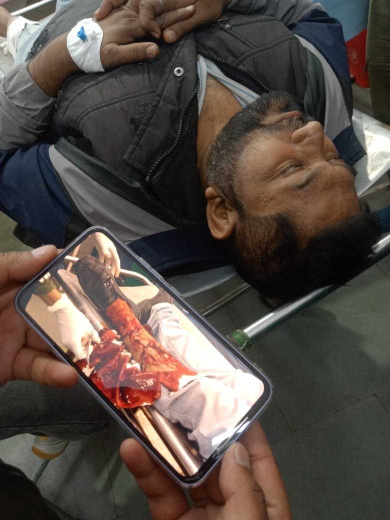 पत्रकार पुष्पेंद्र त्रिपाठी का संघर्ष एक दुर्घटना ने खोली जिला अस्पताल की लापरवाही की परतें!